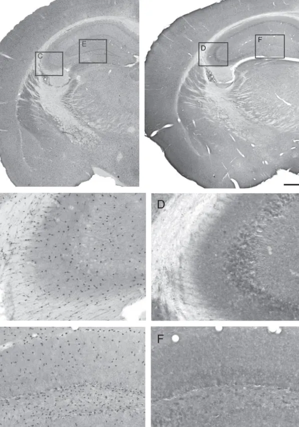 Fig. 3 Photomicrographs of ADK immunoreactivity in coronal brain sections of adult mice, processed for immunoperoxidase staining under identical conditions