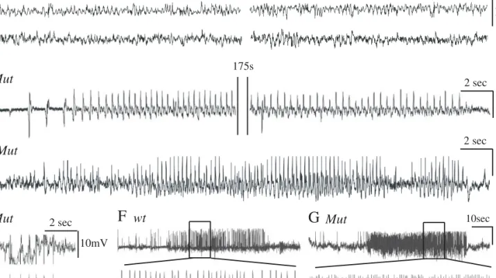 Fig. 5 Representative EEG activities from untreated and KA-injected mice. (A, B) Normal theta activity recorded in untreated wild-type (wt, A) and Adktm1 / -Tg(UbiAdk) (Mut, B) mice