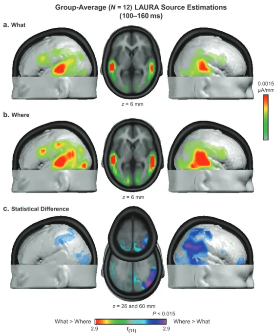 Figure 3 shows the mean LAURA estimations over the 100- to 160-ms period. Both conditions exhibited prominent sources within the posterior superior temporal cortex and prefrontal cortex, bilaterally