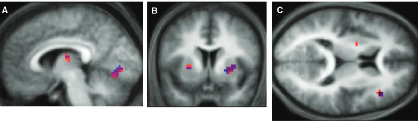 Figure 5. fMRI results. (A) Significant activations in V1 as a function of RW learning, for both the 4-way interaction (CS type 3 CS presence 3 visual outcome 3 RW learning;