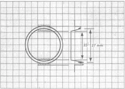 FIG. 5. Errors in the diameter measurement attributable to finite pulse dimensions. Because of the finite pulse dimensions, a gradual transition occurs when the ultrasound pulse (shaded with dots) enters or leaves the vessel walls