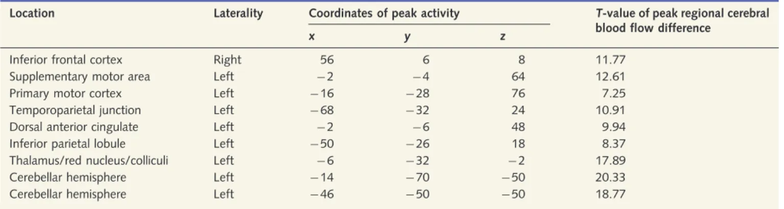 Table 5 Cluster peaks of increased normalized regional cerebral blood flow for the contrast control subjects versus psy- psy-chogenic dystonia averaged across all tasks, within a core motor network, thresholded P 5 0.05, family-wise error corrected for mul