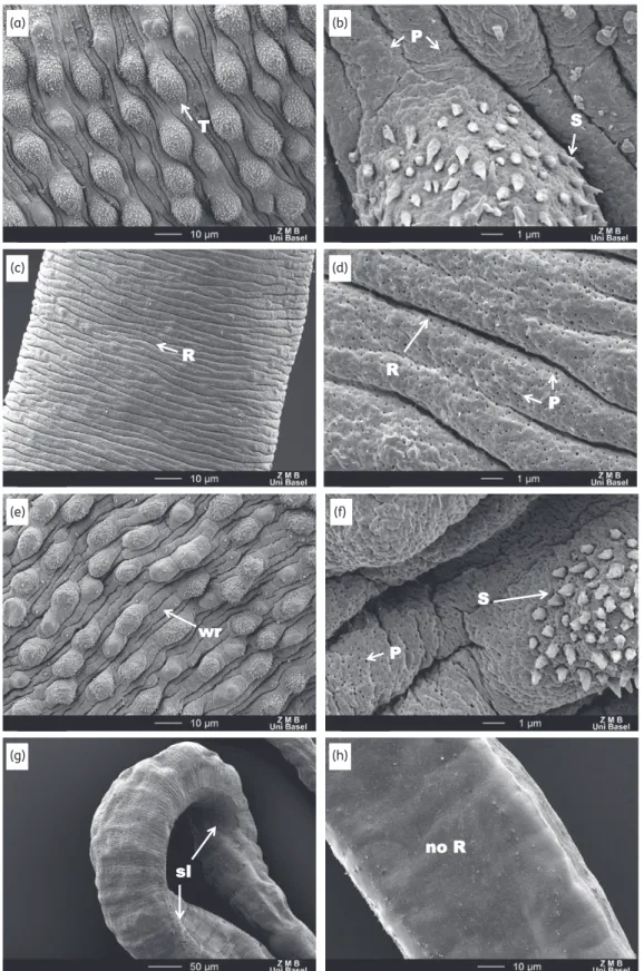 Figure 4. SEM observations of in vitro untreated and Ro 13-3978-treated (100 mg/mL for 72 h) worms