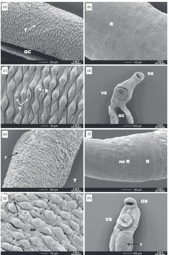 Figure 5. SEM observations of untreated worms and worms extracted from mice treated with 100 mg/kg Ro 13-3978, 24 and 48 h post-treatment.