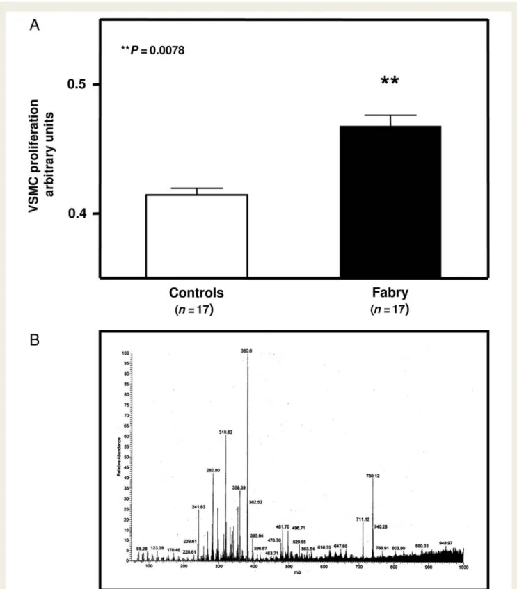 Figure 1 (A) Vascular smooth muscle cell proliferation is significantly increased in the presence of extracted lipid fraction from the plasma of n ¼ 17 patients with Fabry disease compared with that from n ¼ 17 healthy subjects