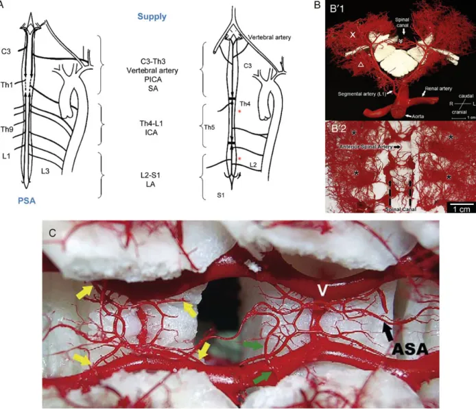 Figure 2: (A) Blood supply to the spinal cord. Schematic drawing of the spinal cord with indications of areas supplied by the posterior and the anterior spinal arteries.