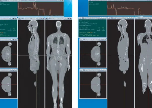 Figure 2a shows the pathlength distribution for 100,000 rays which are incident isotropically on the CT-scan volume