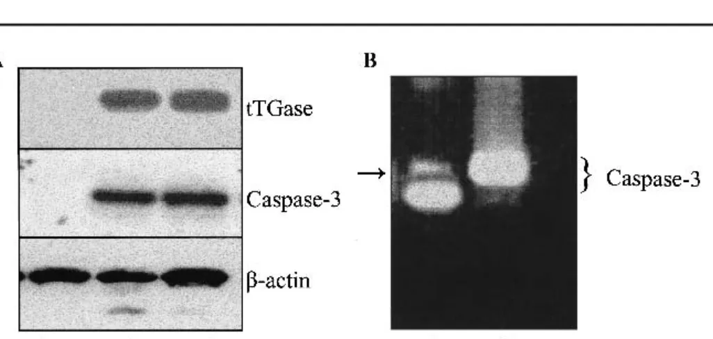 Fig. 1. Tissue transglutaminase (tTGase) and caspase-3 expression in MCF-7, MCF-7/WT/DOX, and MCF-7/DOX cell lines