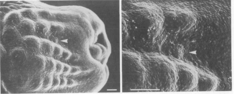 FIGURE 6 Scanning electron micrographs from right muzzle taken from a mouse fetus of 13 days gestational age (conception is on day 0)