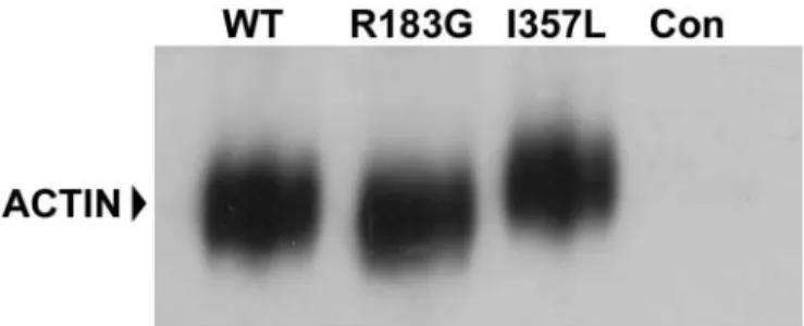 Figure 7. A conservative amino acid substitution (I357L) within alpha-skel- alpha-skel-etal actin results in conformational changes detected by native PAGE.