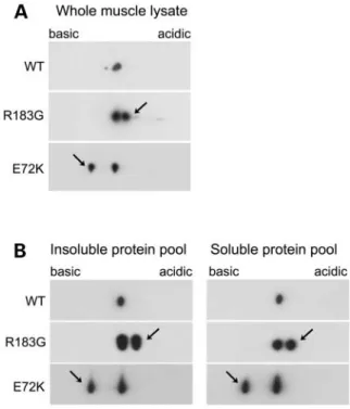 Figure 4. Isoelectric focusing of NM muscle samples supports the hypothesis of a dominant-negative ‘poison-protein’ effect