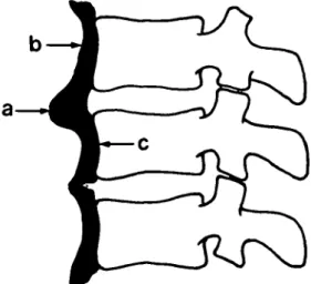 FIG. 1.—Schematic drawing of two spinal segments show- show-ing prediscal (a) and prevertebral (b) ossification with characteristic radioluccnt (c) areas between the vertebral bodies and prevertebral ossification.