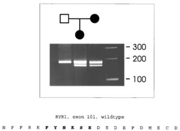 Figure 2 shows that the deleted amino acids are present and conserved in all known vertebrate RYR isoforms.