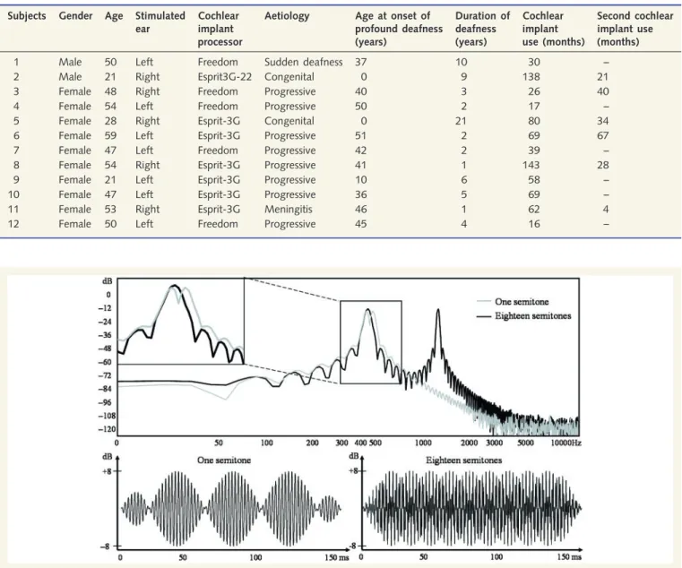 Table 1 Subject demographics of the cochlear implant group