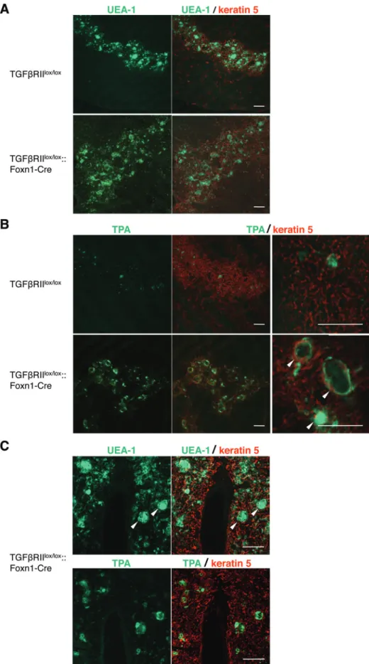 Fig. 1.  Hassall’s corpuscles are developed in mice deficient for TGFβRII on TECs. Immunofluorescence staining in thymic sections of TGFβRII lox/lox    and TGFβRII lox/lox ::Foxn1-Cre mice at the age of 8 weeks was performed to detect keratin 5 (red) and t