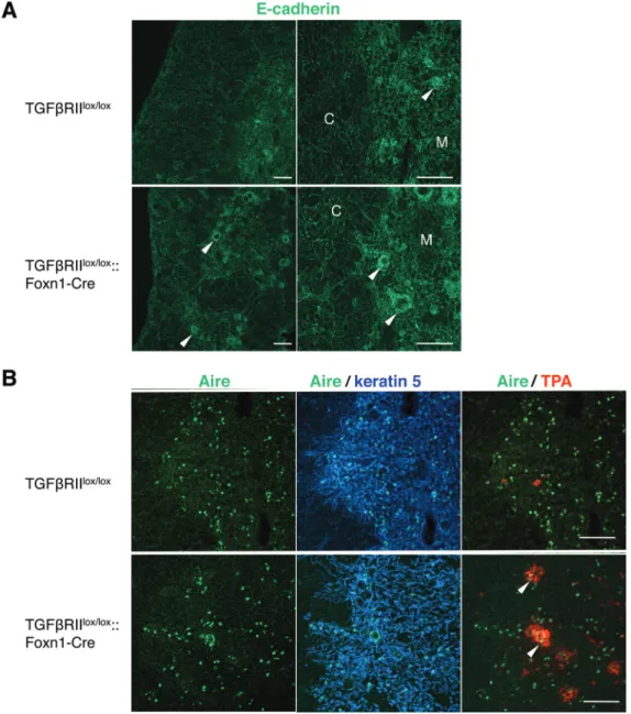 Fig. 3.  Localization of E-cadherin and Aire in the thymi of mice deficient for TGFβRII on TECs