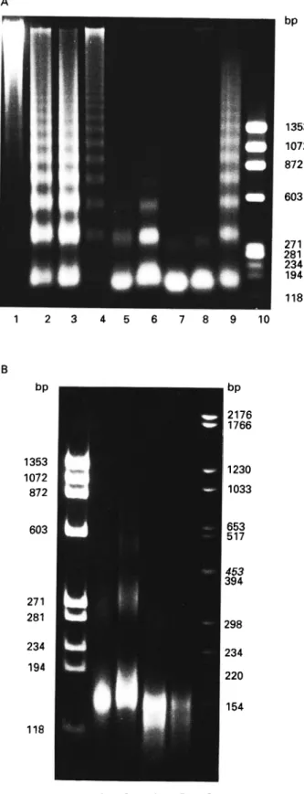 Fig. 5. (A) Separation of DNA fragments in a 1-5%
