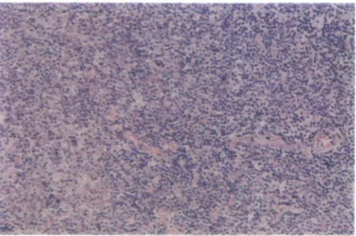 Figure 2. Immunohistochemical staining of a lymph node section with an anti-Ig K light chain antibody (avidin-biotin method with diaminobenzidine as a chromogenic substance)