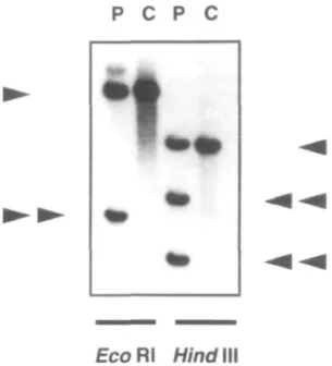 Figure 5. Southern blot detection of clonal Ig gene rearrangements.