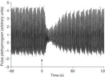 Fig. 1 PPG curve of a typical subject from 60 s before and 120 s after electrical stimulation of the ulnar nerve (arrow).
