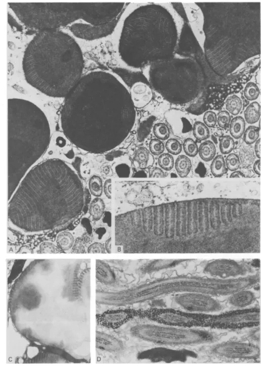 Fig. 2. (A) Higher magnification of globules demonstrating lamellar structure, x 13500