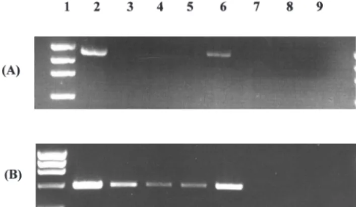 Fig. 2. RT-PCR analysis of total RNA for styS expression in PAA- PAA-grown cells under nutrient-limiting conditions