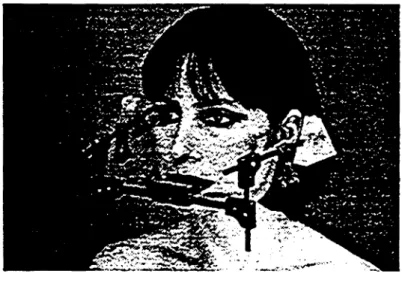 Figur 2: MR-Schnittbild des Kiefergelenks