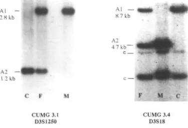 Figure 3. Maternal origin of distal 3p deletion in two patients with  3 p - syndrome.