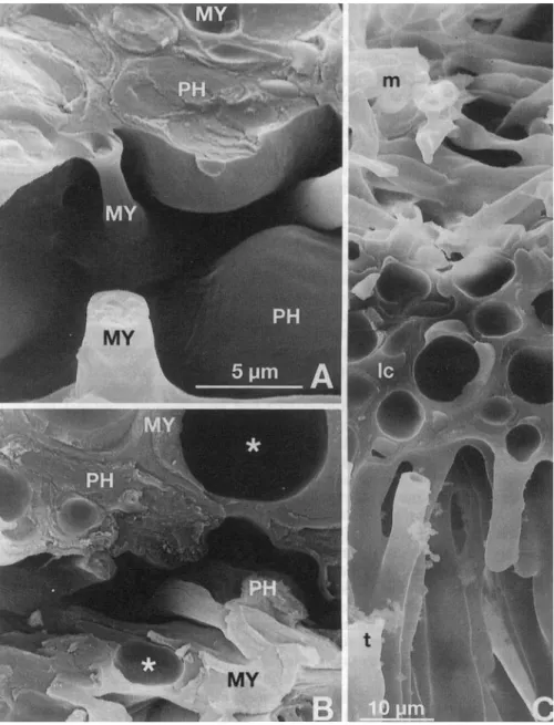 FIG. 3. Drought-stress-induced structural alterations in Sticta sylvatica as seen in LTSEM preparations of fully turgid (A) or desiccated specimens (B-C)