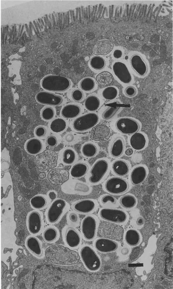 Figure 3. Electron micrograph of a duodenal tissue specimen showing clusters of sporonts and spores of S