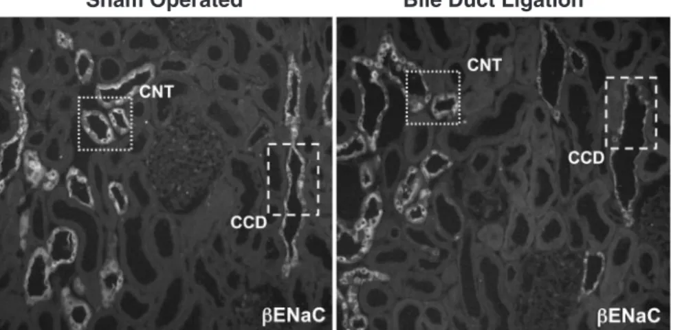 Fig. 5. Immunohistochemical detection of a, b and gENaC in consecutive CNT proﬁles of a sham-operated rat (left panel) and a BDL rat (right panel); consecutive cryosections immunostained with rabbit-anti-rat a, b and gENaC antibodies followed by a  Cy3-con