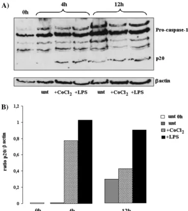 FIG. 7. Time course of the modulation of IL-1b mRNA in CoCl 2 -treated monocytes. CoCl 2 - and LPS (control)-stimulated or untreated monocytes were cultured for 1, 12, and 24 h at 37°C, 7% CO 2 before to be harvested