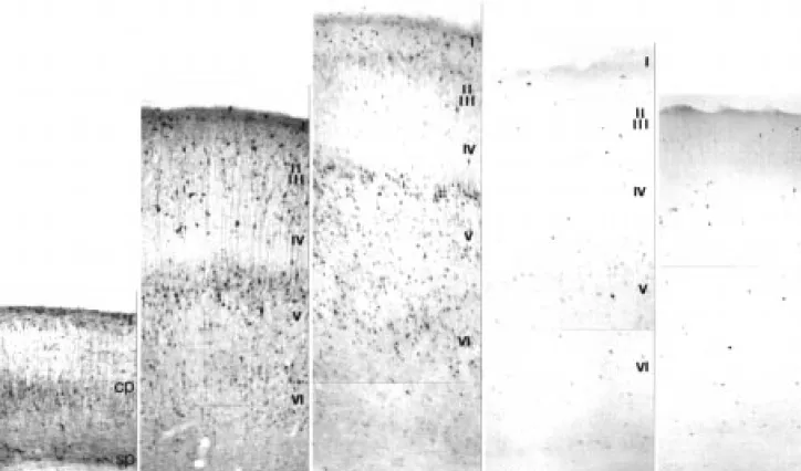 Figure 4. CR-immunoreactivity in the temporal region of rat isocortex on the day of birth (P0), on postnatal days 5 (P5), 10 (P10) and 15 (P15), and in the adult (A)