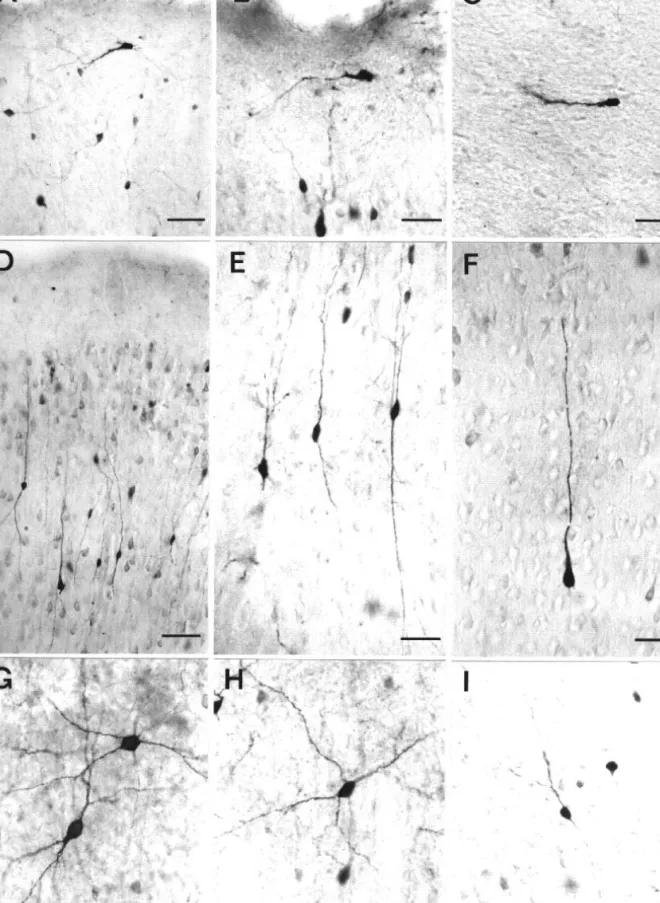 Figure 7. CR-immunoreactive neurons in rat isocortex on postnatal days 15 (A, D, F, G) and 30 (E, H) and in the adult (B, C, I)