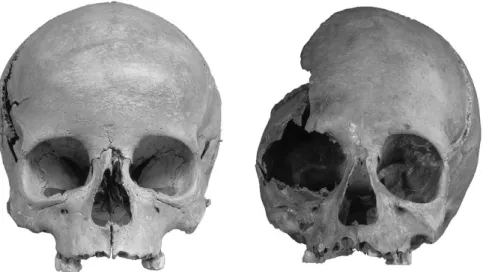 Figure 4. Skulls of two of the children: left) S.4 (boy); and right) IP.6 (girl); both found at Wasserburg-Buchau ( R
