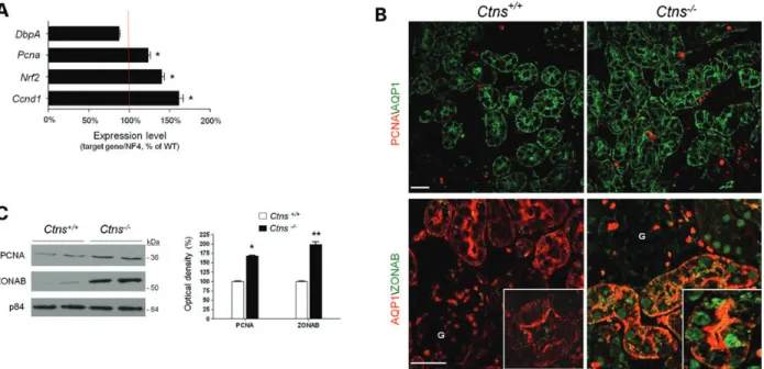 Figure 5. Ctns 2/2 kidneys: dedifferentiation and proliferation. (A) Quantitative RT-PCR analysis of the expression of the proliferation markers Pcna (PCNA) and Ccnd1 (Cyclin D1) and the transcription factors Nrf2 (NRF2) and DbpA (ZONAB) mRNA in whole kidn