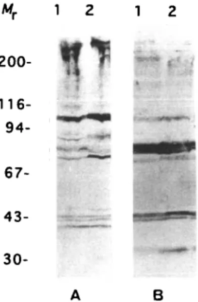 Fig. 1. Western blot analysis of whole trypanosomal cell extracts (Lane 1) and cytoskeletons (Lane 2) probed with (A) a bovine serum taken 14 days after infection and (B) with an anti-cytoskeleton rat hyperimmune serum