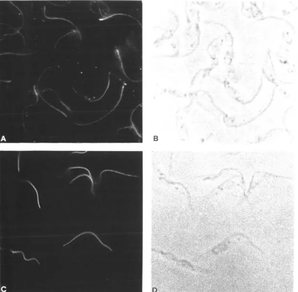 Fig. 6. Intracellular localization of I 2  and I 17  by immunofluorescence microscopy (A and C)