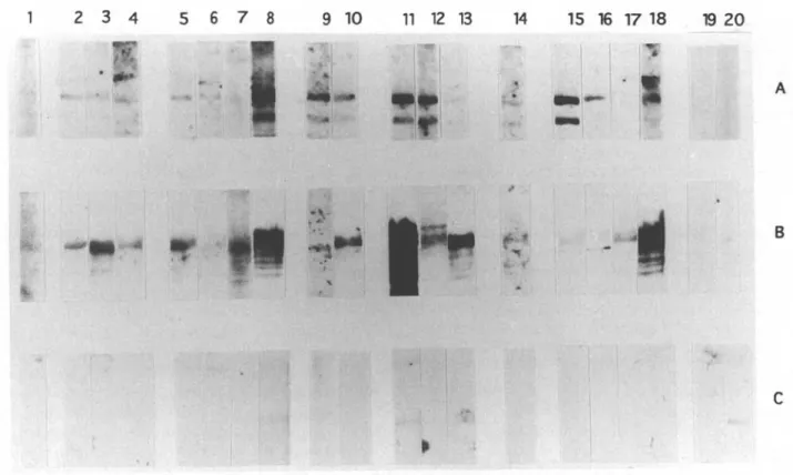 Fig. 8. Western blot analysis demonstrating the diagnostic sensitivity of I 2  and I 17 