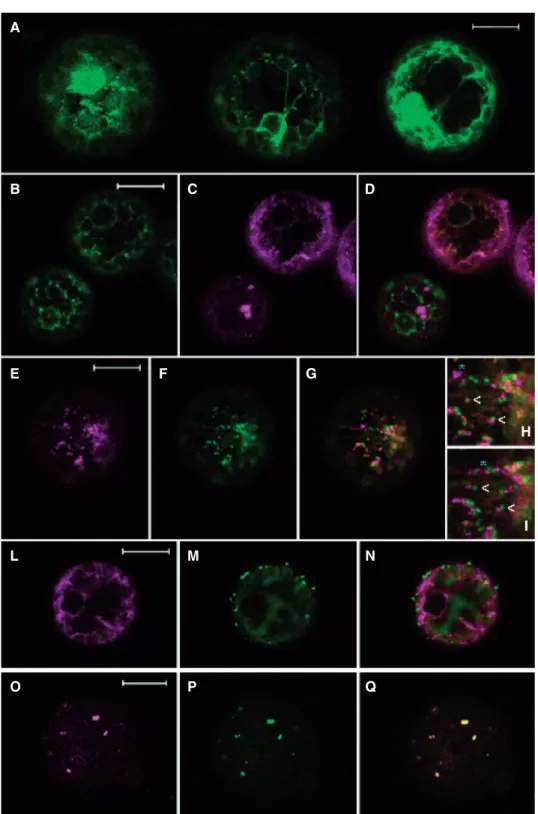 Fig. 4 Fluorescence patterns of Rab11 variants fused to a GFP or RFP tag expressed in protoplasts