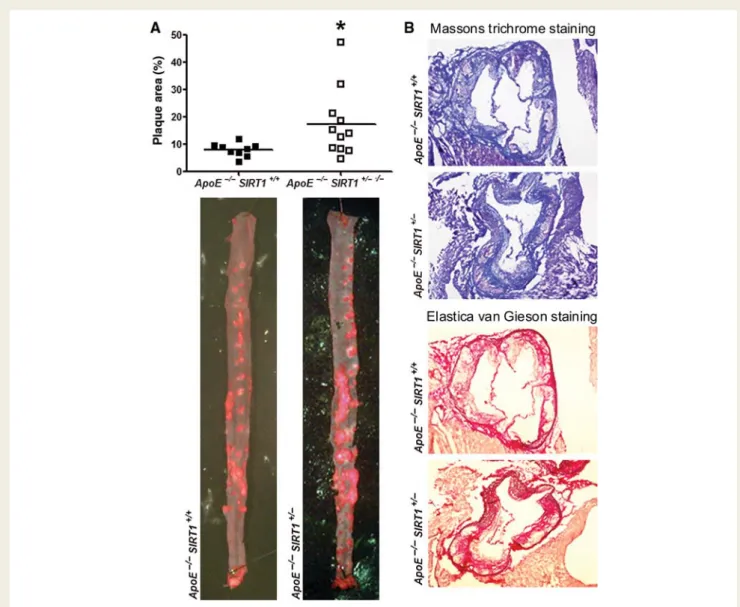 Figure 1 SIRT1 protects mice against atherosclerosis. (A) En face Oil red O (ORO) staining of thoraco-abdominal aortae and quantifications of plaque area