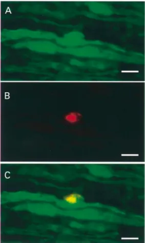 Fig. 1 A proliferating Schwann cell on a longitudinal section of a sciatic nerve from a PMP22 transgenic mouse at P21