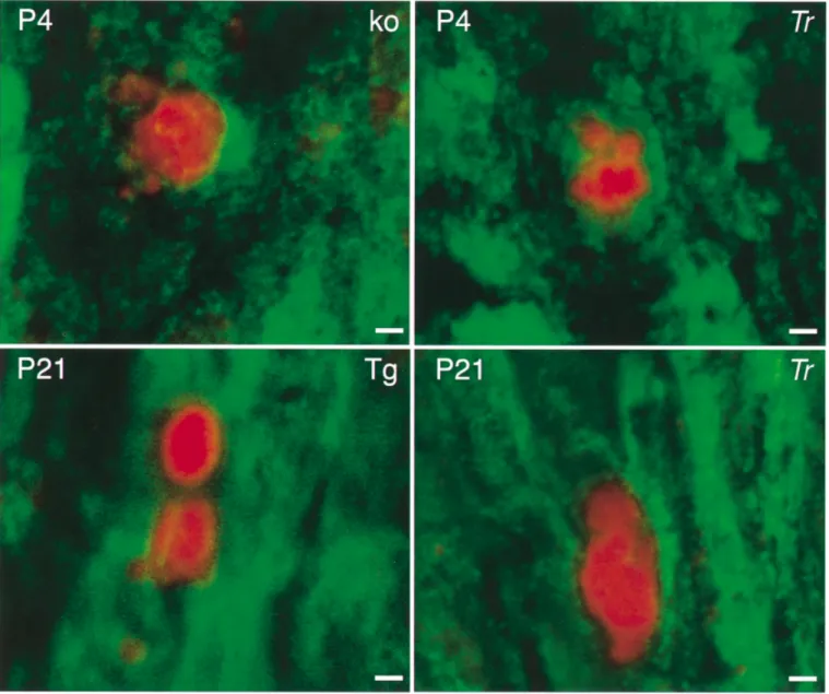 Fig. 3 Confocal microscopy of TUNEL immunoreactivity on longitudinal sections of sciatic nerves from PMP22 mutant sciatic nerves.