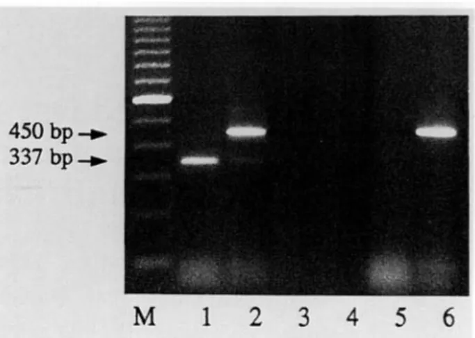 Fig. 1. Detection of amplification products after gel electrophoresis and ethidium bromide staining