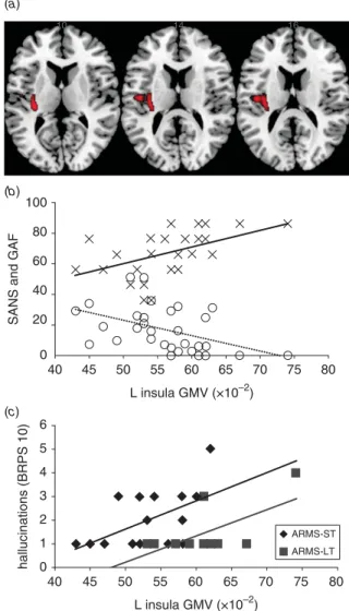 Fig. 1. Correlation of psychopathology and grey matter volume (GMV) in the right (R) insula