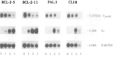 Fig. 4. Northern blot analysis of all four pre-B cell lines and clones at different times after induction of differentiation in the absence of IL-7