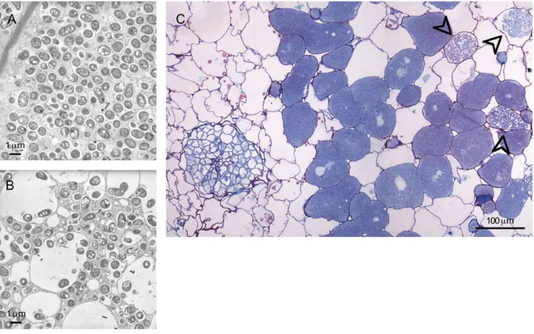 Fig. 6. Electron (A &amp; B) and light (C) micrographs of 7 month-old nodules containing NGR234