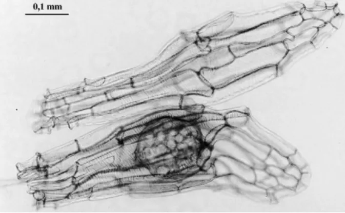 Figure 1. Viable (bottom) and nonviable (top) orchid seeds stained with 50% lactic acid.