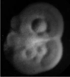 Figure 3. White to buff-brown mould form of H. capsulatum grown at 25°C on Sabouraud ’ s dextrose agar