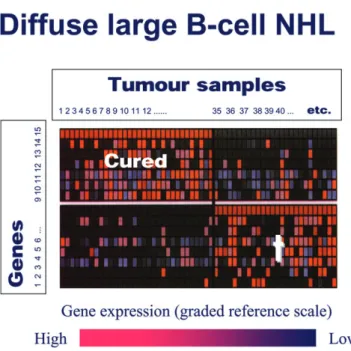 Figure 1. Gene expression profiling of tumours with cDNA microarrays or ‘chips’. The chip is a small flat box (upper left) which in a rectangular chamber contains a siliconized surface loaded with single-strand nucleic acid sequences (lower left)
